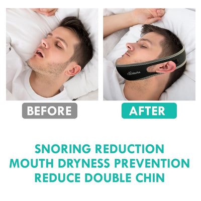 Twin Pack Anti-Snore Strap